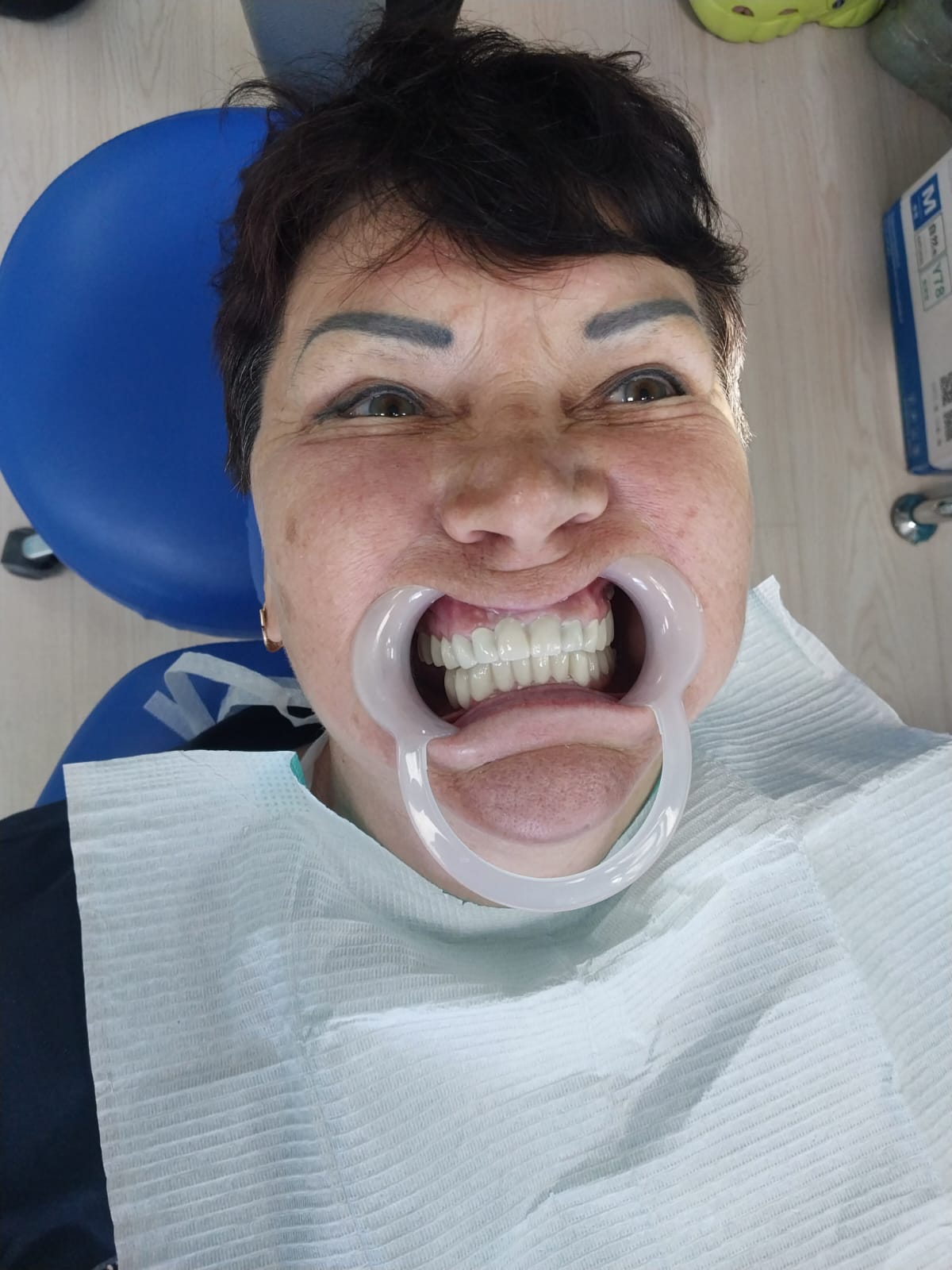 Отзыв о протезировании зубов в Китае после
